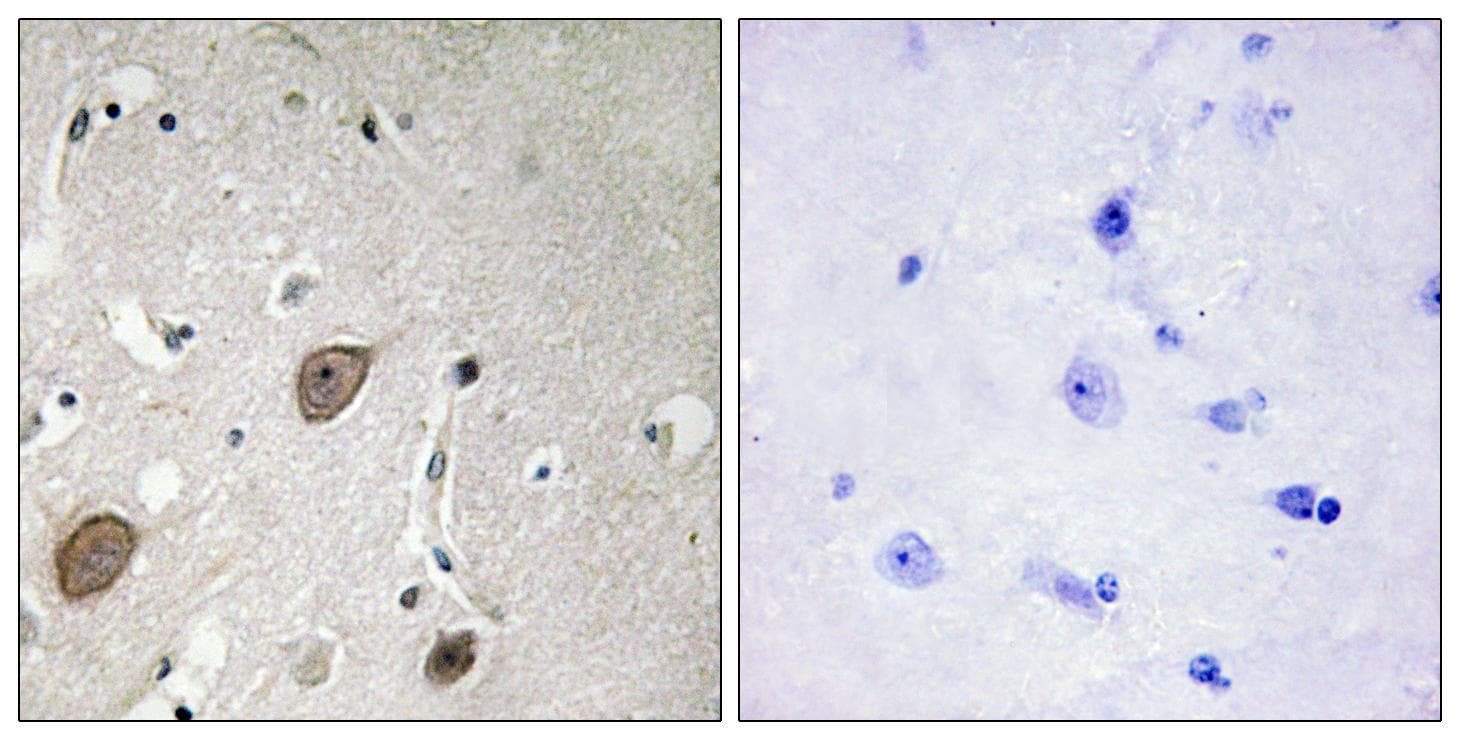 BEGAIN Antibody