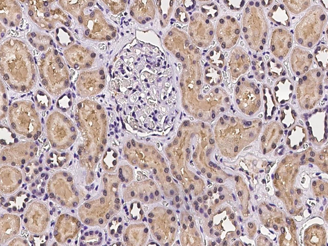 Polyclonal Rabbit anti-Human DAO / D Amino Acid Oxidase Antibody (IHC)