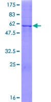Human HSD17B11 Protein (Recombinant GST)