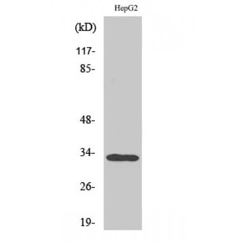 Polyclonal Rabbit anti-Human TNFRSF6B / DCR3 Antibody (220-300 aa, C-terminal, IHC, IF, WB)