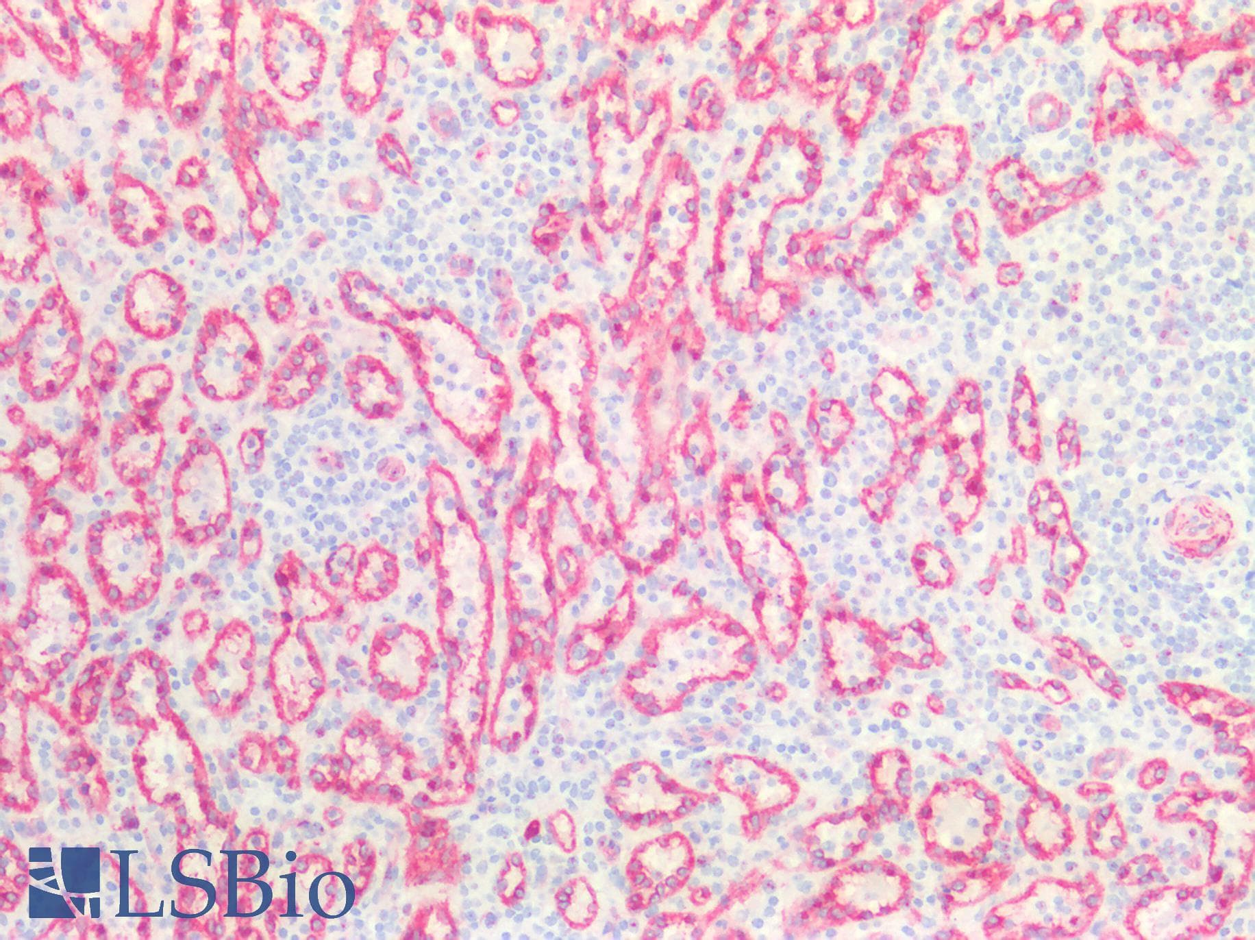 IHC-plus™ CAV1 / Caveolin 1 Antibody (N-Terminus)