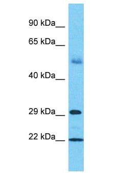 ZNF562 Antibody (aa230-279)