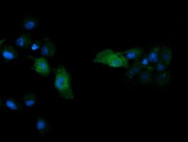 MAPK13 / p38delta Antibody (clone OTI2A10)