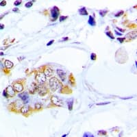 Polyclonal Rabbit anti-Human EIF2AK3 / PERK Antibody (N-Terminus, IHC, WB)