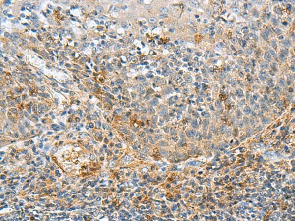 Polyclonal Rabbit anti-Human FAM82A1 Antibody (IHC)