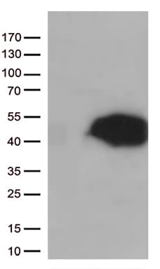 ARG1 / Arginase 1 Antibody (clone OTI4D7, Carrier-free)