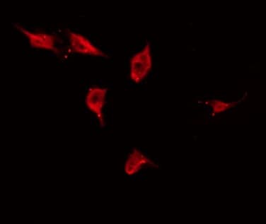 Polyclonal Rabbit anti-Human TP53I11 / PIG11 Antibody (IHC, IF, WB)