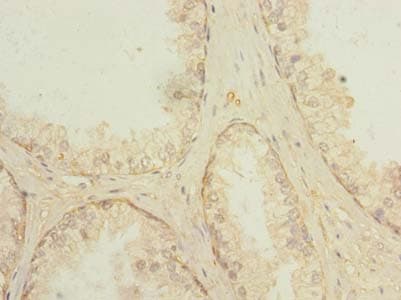 PROSC Antibody