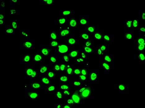 EFTUD2 Antibody
