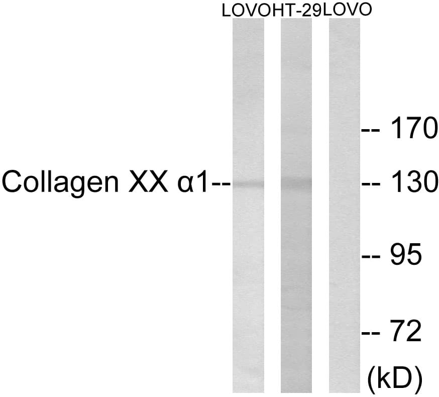 Polyclonal Rabbit anti-Human COL20A1 / Collagen XX Antibody (aa1151-1200, IHC, IF, WB)