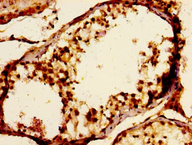 Polyclonal Rabbit anti-Human JAM3 Antibody (IHC, WB)