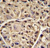 Polyclonal Rabbit anti-Human ELOVL6 Antibody (aa32-58, IHC, WB)
