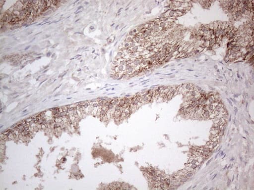 GLOD2 / MCEE Antibody (clone OTI11G7)