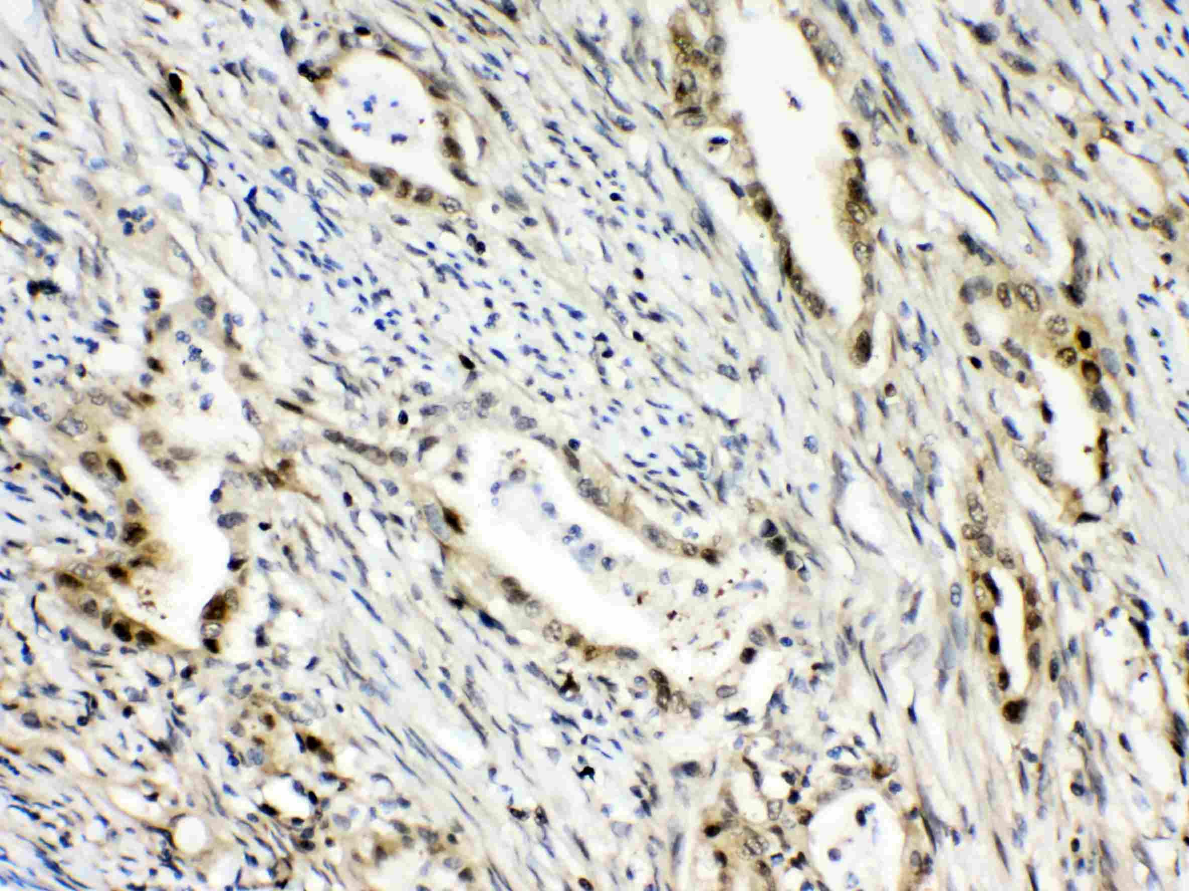 Polyclonal Rabbit anti-Human RANBP1 Antibody (IHC, WB)