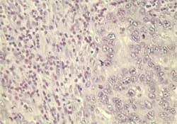 Polyclonal Rabbit anti-Human WNT5A Antibody (aa190-230, IHC, WB)