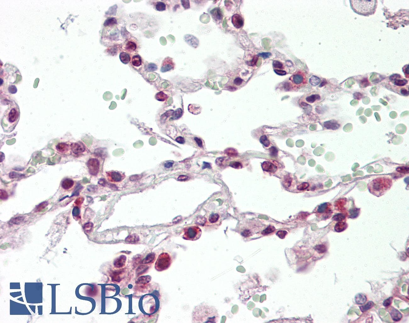 PathPlus™ ASCL1 / MASH1 Antibody