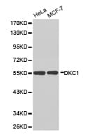 DKC1 / Dyskerin Antibody