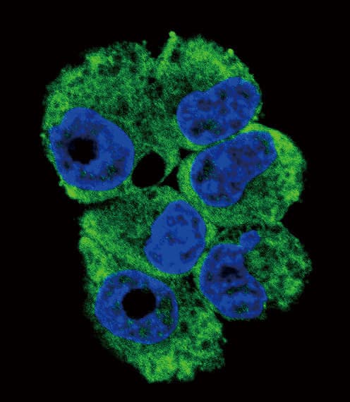 Polyclonal Rabbit anti-Human CD40L Antibody (aa33-62, IHC, IF, WB)