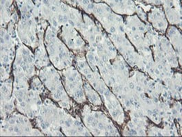 Monoclonal Mouse anti-Human PECAM-1 / CD31 Antibody (clone OTI1C2, IHC, WB)