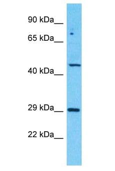ZBTB8B Antibody (aa444-493)