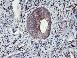 Monoclonal Mouse anti-Human VASP Antibody (clone OTI1F3, IHC, WB)