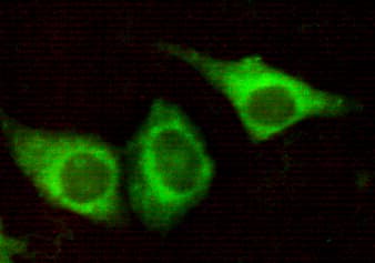 Monoclonal Mouse anti-Human KRT7 / CK7 / Cytokeratin 7 Antibody (N-Terminus, IF, WB)