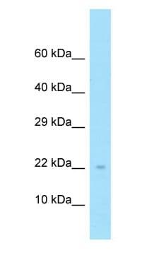 Polyclonal Rabbit anti-Human NDUFS4 Antibody (aa80-129, WB)