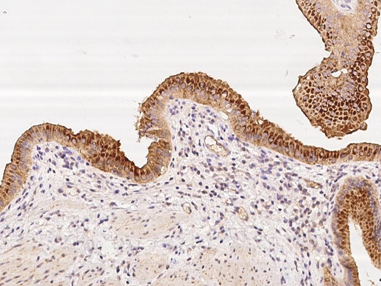 Polyclonal Rabbit anti-Human SPP1 / Osteopontin Antibody (IHC)