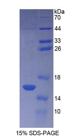 Human ATP5J Protein (Recombinant His, N-Terminal)