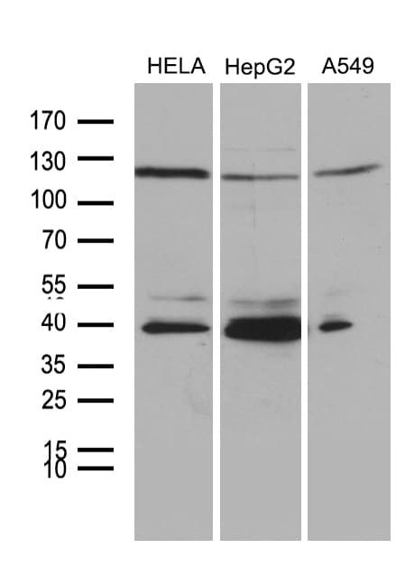 Monoclonal Mouse anti-Human PHF20L1 Antibody (clone OTI6G6, IHC, WB)
