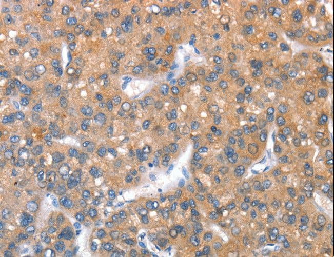 KEL / CD238 Antibody