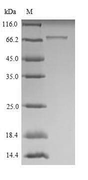 Mouse ROBO1 Protein (Recombinant 6His, N-terminus)