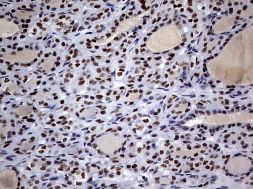 DDX56 Antibody (aa323-547, clone OTI11H7, Carrier-free)