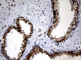 NBN / Nibrin Antibody (clone OTI3A2)