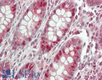 IHC-plus™ RECQL4 Antibody (C-Terminus)