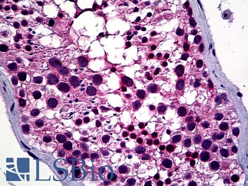 IHC-plus™ HDAC6 Antibody (aa7-56)