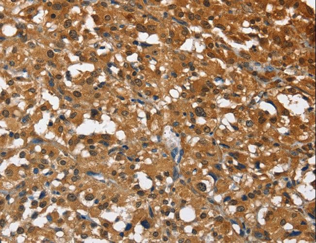 STK17B / DRAK2 Antibody