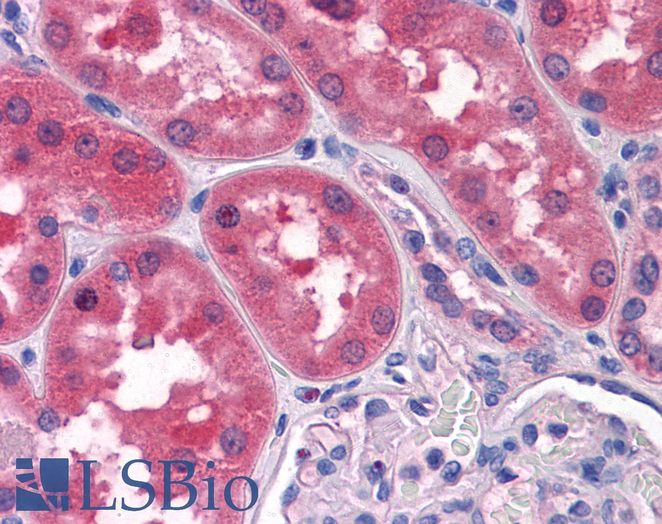 IHC-plus™ TWIST2 Antibody (clone 3C8)