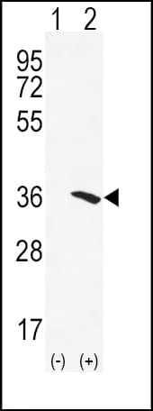 NAT2 Antibody (aa226-254)