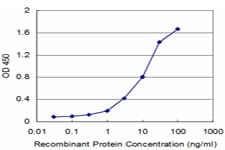 Monoclonal Mouse anti-Human CTNNA1 / Catenin Alpha-1 Antibody (clone 4G6, WB)