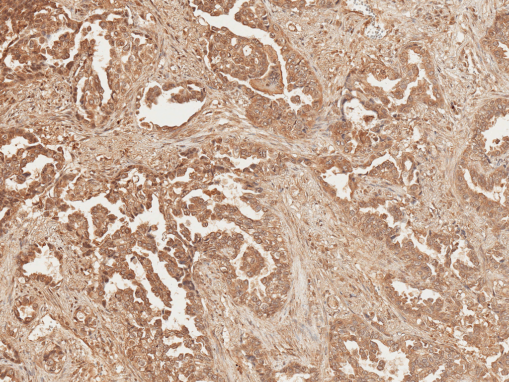 AXIN2 / Axin 2 Antibody