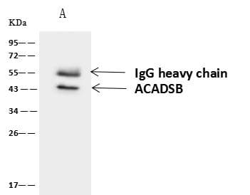 Polyclonal Rabbit anti-Human ACADSB Antibody (IHC, WB)