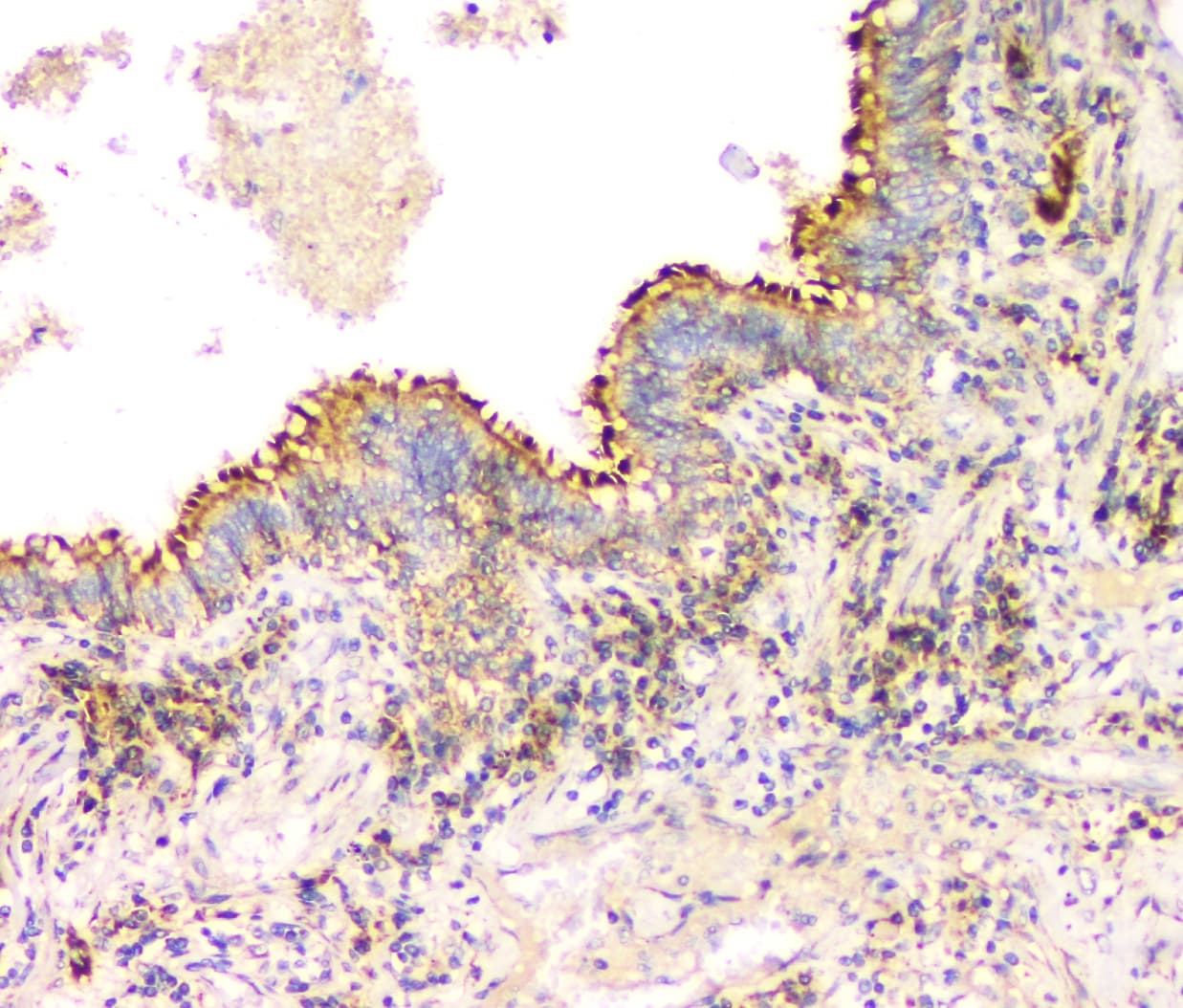 IFN Gamma / Interferon Gamma Antibody