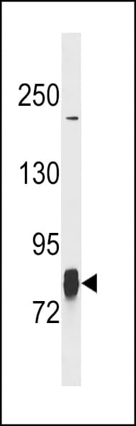 Polyclonal Rabbit anti-Human LIMK1 / LIMK Antibody (aa1-30, IHC, WB)