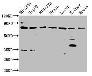 Polyclonal Rabbit anti-Human CUX1 / CASP Antibody (IHC, WB)