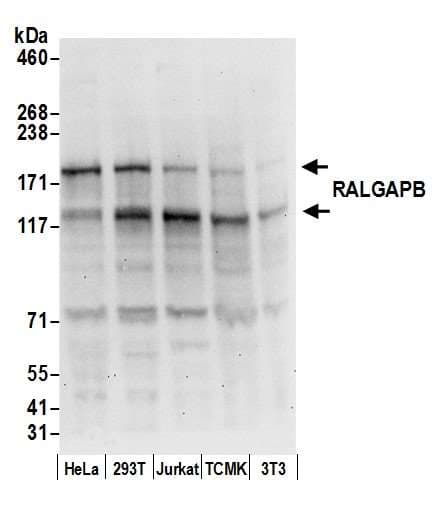 Polyclonal Rabbit anti-Human RALGAPB / KIAA1219 Antibody (aa1025-1075, IHC, WB)