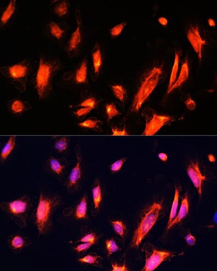 Polyclonal Rabbit anti-Human ARL4A / ARL4 Antibody (IHC, IF)