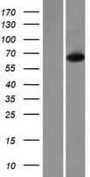 CHDH / CHD Protein (Over-Expression Lysate Myc-DDK (Flag))