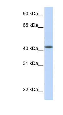 DENND1B Antibody (aa108-157)