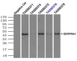 SERPINA1 / Alpha 1 Antitrypsin Antibody (clone OTI8E3)